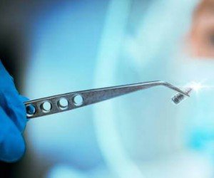Dental Tweezers